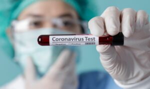 Nurse holding testing patients blood samples for Coronavirus Out Ilustrasi tes virus corona atau covid 19 6