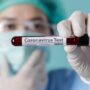 Ilustrasi tes virus corona atau covid 19 6
