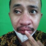 foto korban foto korban