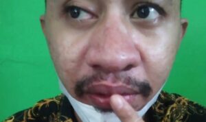 foto korban