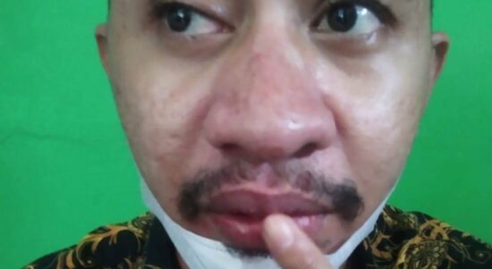 foto korban