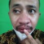 foto korban